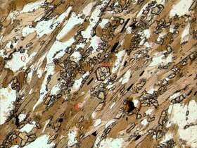 粒状-片状变晶结构