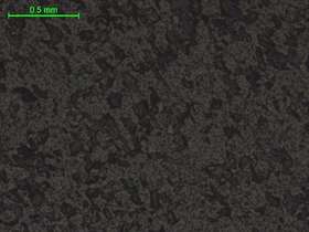 二云母斜长片麻岩